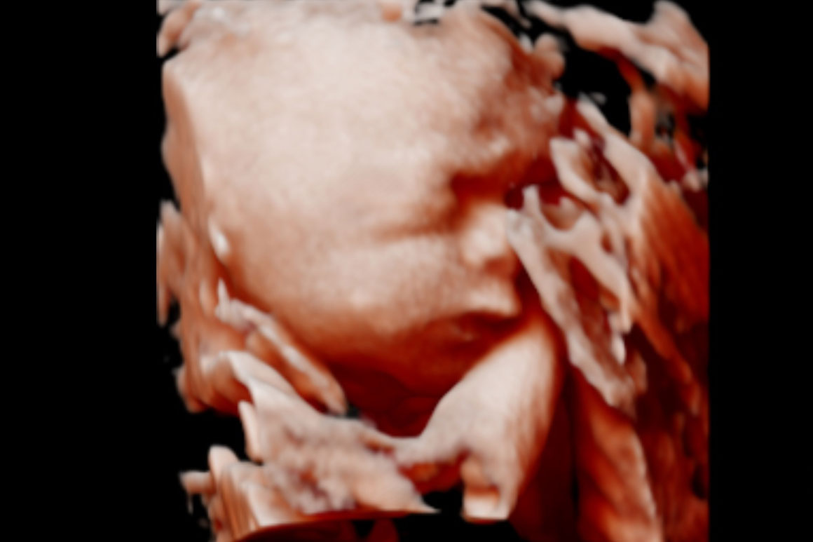 Zwangerschapsupdate #33: Babymoon & 3d echo