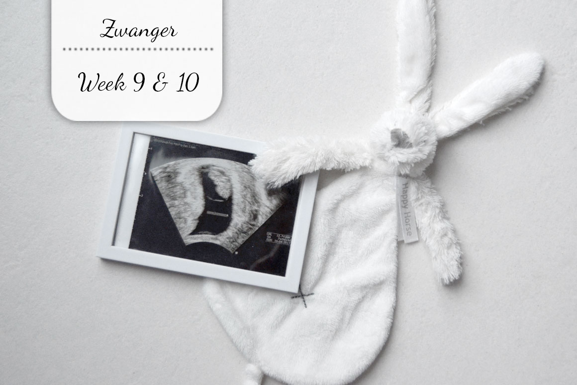 Zwangerschapsupdate #4: Week 9 & 10